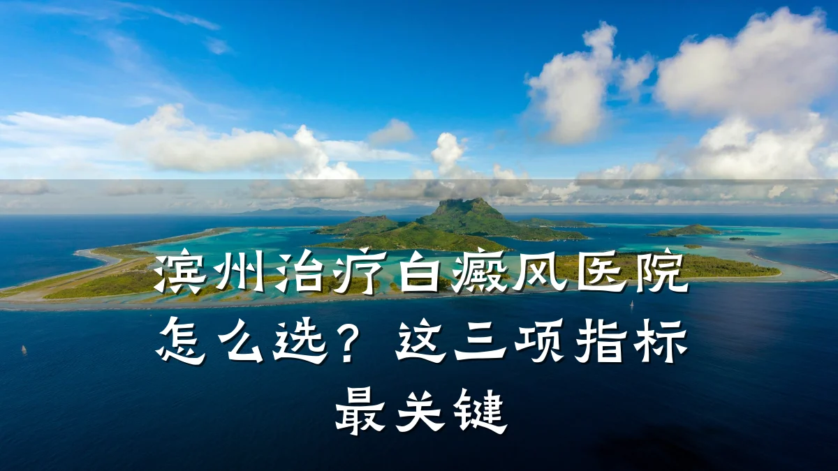 滨州治疗白癜风医院怎么选？这三项指标最关键
